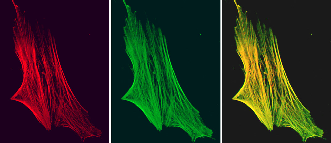 Figure 7. Indirect immunofluorescence staining of a cultured human fibroblast, showing colocalization of smoothelin (red fluorescence; as detected by MUB1700P, R4A) and actin (green fluorescence).